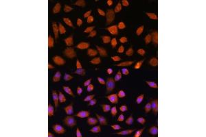 Immunofluorescence analysis of L929 cells using PLD3 Rabbit pAb (ABIN7269351) at dilution of 1:100. (PLD3 抗体)