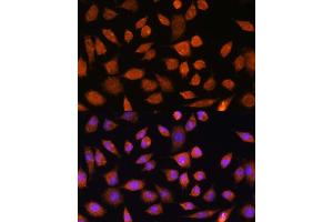 Immunofluorescence analysis of L929 cells using PLD3 Rabbit pAb (ABIN7269351) at dilution of 1:100. (PLD3 抗体)