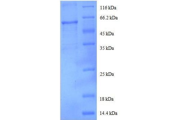 DDX39B Protein (AA 2-251, partial) (GST tag)