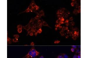 Immunofluorescence analysis of HeLa cells using B4GALT4 Polyclonal Antibody at dilution of 1:100. (B4GALT4 抗体)