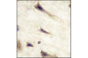 Immunohistochemistry (IHC) image for anti-EPH Receptor A5 (EPHA5) antibody (ABIN356398) (EPH Receptor A5 抗体)
