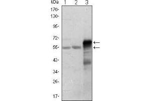 Western Blot showing ETS1 antibody used against Jurkat (1), HepG2 (2) and ETS1-hIgGFc transfected HEK293 (3) cell lysate. (ETS1 抗体)