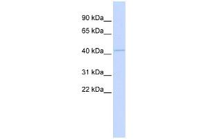 WB Suggested Anti-MITF Antibody Titration:  0. (MITF 抗体  (Middle Region))