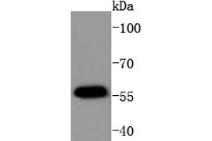 MCF-7 Cell lysates, probed with AKT1(T450) (4A3) Monoclonal Antibody  at 1:1000 overnight at 4˚C. (AKT1 抗体  (pThr450))