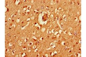 Immunohistochemistry of paraffin-embedded human brain tissue using ABIN7155237 at dilution of 1:100 (HRH3 抗体  (AA 236-332))