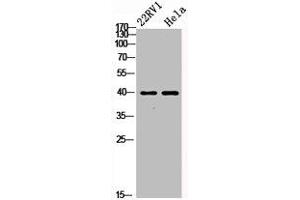Western Blot analysis of 22RV1 HELA cells using PKAα/β/γ cat Polyclonal Antibody