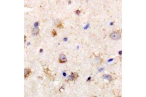 Immunohistochemical analysis of PGD2 synthase staining in rat brain formalin fixed paraffin embedded tissue section.