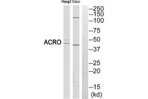 Western blot analysis of extracts from HEPG2 cells and COLO cells, using ACRO (heavy chain, Cleaved-Ile43) antibody. (Acrosin 抗体  (Cleaved-Ile43, N-Term))