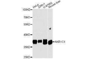 Western blot analysis of extracts of various cell lines, using AKR1C1 antibody. (AKR1C1 抗体  (AA 1-323))