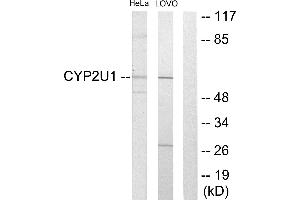 Western blot analysis of extracts from HeLa cells and Lovo cells, using Cytochrome P450 2U1 antibody. (CYP2U1 抗体)