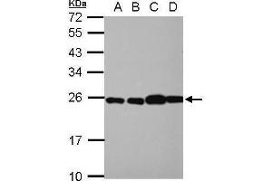 WB Image Sample (30 ug of whole cell lysate) A: NT2D1 B: PC-3 C: U87-MG D: SK-N-SH 12% SDS PAGE antibody diluted at 1:10000 (RPL29 抗体)