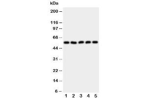 Western blot testing of HYAL2 antibody and Lane 1:  HeLa (HYAL2 抗体  (AA 142-157))