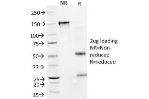 SDS-PAGE Analysis Purified IFNA2 Mouse Monoclonal Antibody (N27). (IFNA2 抗体)