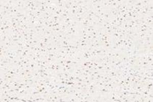 Immunohistochemistry (Paraffin-embedded Sections) (IHC (p)) image for anti-Acidic (Leucine-Rich) Nuclear phosphoprotein 32 Family, Member B (ANP32B) antibody (ABIN7072887)