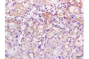 Formalin-fixed and paraffin embedded human kidney tissue labeled with Anti-Acetyl-Histone H1b(K53) Polyclonal Antibody (ABIN729973), Unconjugated at 1:200, followed by conjugation to the secondary antibody and DAB staining (Histone H1 抗体  (acLys52))