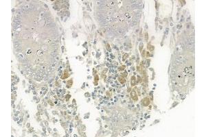 ABIN6259448 and ABIN6275352 at 1/100 staining human normal colon tissue by IHC-P. (PEX2 抗体  (Internal Region))