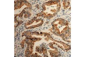 Immunohistochemistry (IHC) image for anti-Integrin alpha 2 (ITGA2) (C-Term) antibody (ABIN7304546)