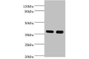 Western blot All lanes: CD1A antibody at 6 μg/mL Lane 1: K562 whole cell lysate Lane 2: Mouse thymus tissue Secondary Goat polyclonal to rabbit IgG at 1/10000 dilution Predicted band size: 37 kDa Observed band size: 37 kDa (CD1a 抗体  (AA 21-181))