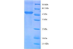 Ribosomal Protein S9 (RPS9) (AA 2-184), (partial) protein (GST tag) (RPS9 Protein (AA 2-184, partial) (GST tag))