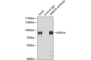 Immunoprecipitation analysis of 150 μg extracts of MCF7 cells using 3 μg A antibody (ABIN6131196, ABIN6137102, ABIN6137103 and ABIN6223591). (ARID3A 抗体  (AA 324-593))