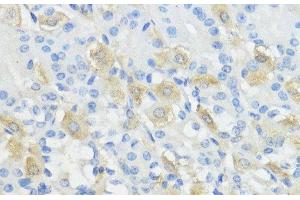 Immunohistochemistry of paraffin-embedded Mouse stomach using GPX2 Polyclonal Antibody at dilution of 1:100 (40x lens). (Glutathione Peroxidase 2 抗体)