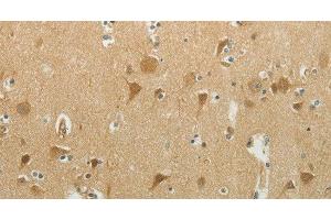 Immunohistochemistry of paraffin-embedded Human brain using MCM4 Polyclonal Antibody at dilution of 1:40 (MCM4 抗体)