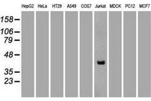 Western blot analysis of extracts (35 µg) from 9 different cell lines by using anti-CD2 monoclonal antibody. (CD2 抗体)