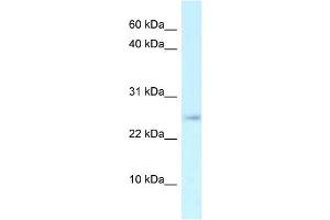 WB Suggested Anti-Arpp21 Antibody   Titration: 1. (ARPP21 抗体  (N-Term))