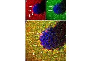 Expression of SSTR5 in mouse cerebellum - Immunohistochemical staining of Somatostatin receptor 5 (SSTR5) in mouse cerebellum using Anti-Somatostatin Receptor Type 5 (extracellular) Antibody (ABIN7043767 and ABIN7045267). (SSTR5 抗体  (Extracellular, N-Term))