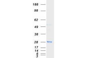 RAB8A Protein (Myc-DYKDDDDK Tag)