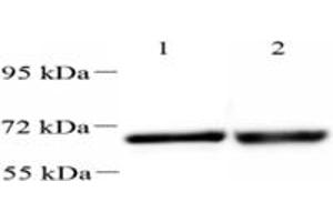 Western blot analysis of UCKL1 (ABIN7076157),at dilution of 1: 2000,Lane 1: HeLa cell lysate,Lane 2: Mouse kidney tissue lysate (UCKL1 抗体)