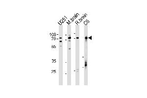 Western blot analysis in U251,rat C6 cell line,mouse brain,rat brain tissue lysates (35ug/lane).