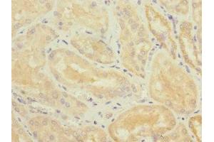 Immunohistochemistry of paraffin-embedded human kidney tissue using ABIN7173811 at dilution of 1:100