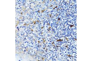 Immunohistochemistry (Paraffin-embedded Sections) (IHC (p)) image for anti-Catenin (Cadherin-Associated Protein), beta 1, 88kDa (CTNNB1) (AA 1-100) antibody (ABIN6139205)