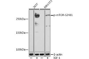 Western blot analysis of extracts of various cell lines, using Phospho-mTOR-S2481 (ABIN7268436) at 1:1000 dilution. (MTOR 抗体  (pSer2481))