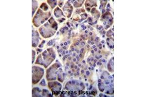 C6orf138 Antibody (Center) immunohistochemistry analysis in formalin fixed and paraffin embedded human pancreas tissue followed by peroxidase conjugation of the secondary antibody and DAB staining. (PTCHD4 抗体  (Middle Region))