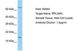 Image no. 1 for anti-Ribosomal Protein L36a-Like (RPL36AL) (C-Term) antibody (ABIN6749891) (RPL36AL 抗体  (C-Term))