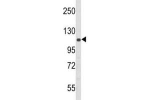 Western blot analysis of PERK antibody and 293 lysate (PERK 抗体  (AA 148-175))