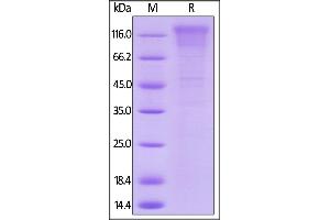 SDS-PAGE (SDS) image for CD96 (CD96) (AA 22-503) (Active) protein (His tag,AVI tag,Biotin) (ABIN5954915)