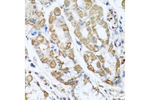 Immunohistochemistry of paraffin-embedded human stomach using ANTXR2 antibody. (ANTXR2 抗体  (AA 339-488))