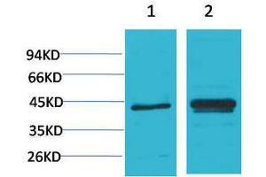 Western Blotting (WB) image for anti-Nuclear Factor of kappa Light Polypeptide Gene Enhancer in B-Cells Inhibitor, alpha (NFKBIA) antibody (ABIN3188043)