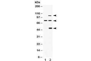 Western blot testing of 1) rat brain and 2) human 293 lysate with PACE4 antibody. (PCSK6 抗体)