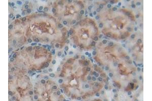 DAB staining on IHC-P; Samples: Rat Kidney Tissue (CD90 抗体  (AA 1-161))