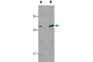 Western blot analysis of ATG12 in human brain tissue lysate with ATG12 polyclonal antibody  at (A) 0. (ATG12 抗体  (N-Term))