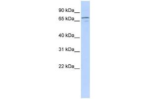 WB Suggested Anti-NRG3 Antibody Titration:  0. (Neuregulin 3 抗体  (Middle Region))