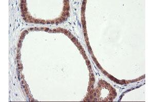 Immunohistochemical staining of paraffin-embedded Human breast tissue using anti-RGS16 mouse monoclonal antibody. (RGS16 抗体)