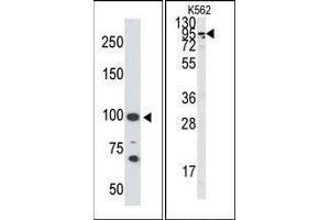 Image no. 1 for anti-Angiotensin I Converting Enzyme 2 (ACE2) (C-Term) antibody (ABIN358578)