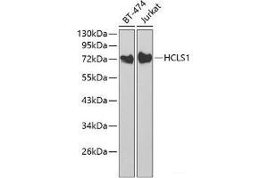 Western blot analysis of extracts of various cell lines using HCLS1 Polyclonal Antibody at dilution of 1:1000. (HCLS1 抗体)