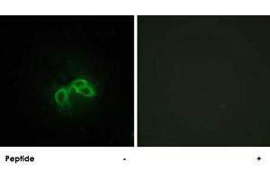 Immunofluorescence analysis of NIH/3T3 cells, using BLCAP polyclonal antibody . (BLCAP 抗体  (Internal Region))