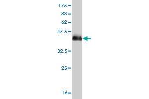 Western Blot detection against Immunogen (38. (DLX2 抗体  (AA 1-110))